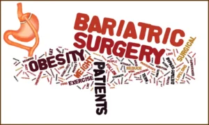 Read more about the article Bariatric Surgery Reduces Emotional Eating in the Short Term: Study