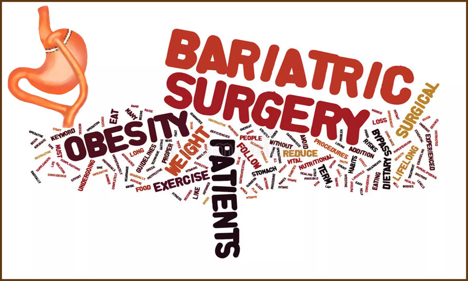 You are currently viewing Bariatric Surgery Reduces Emotional Eating in the Short Term: Study