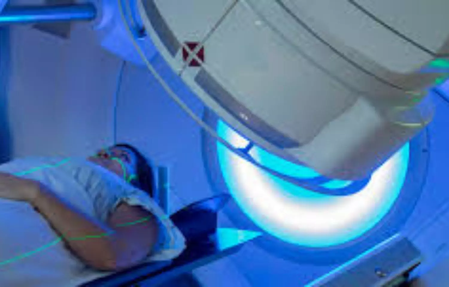 You are currently viewing Radiotherapy more effective when administered at the right time of day: Study