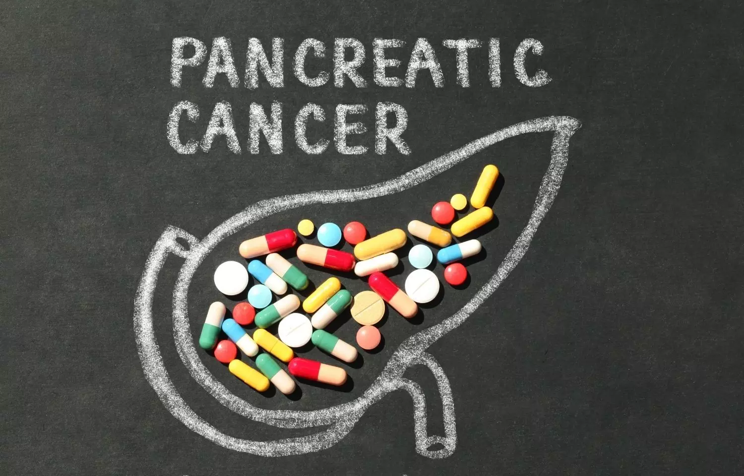 Read more about the article FDA Approves First-of-Its-Kind Device to Treat Pancreatic Cancer