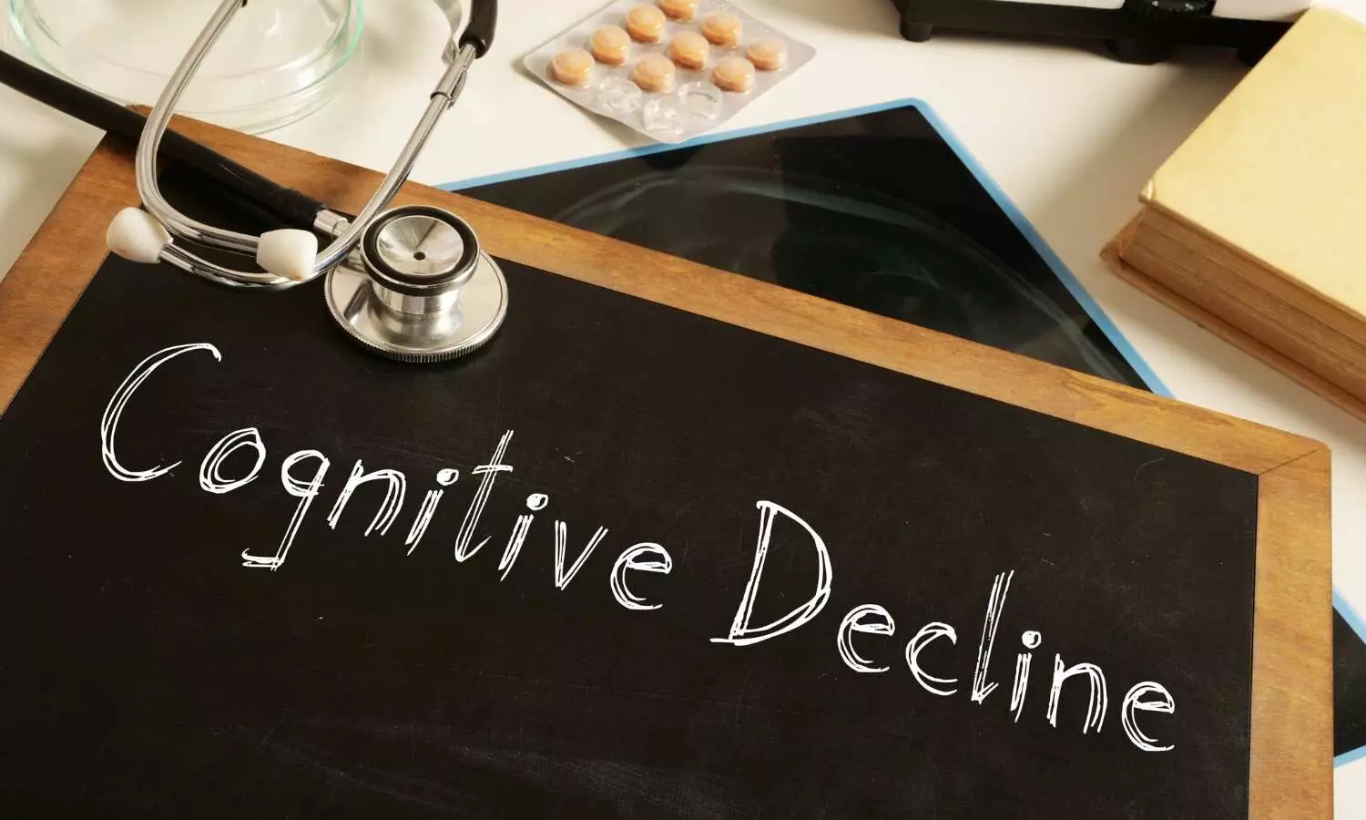 You are currently viewing Common bacteria discovered in the eye linked to cognitive decline: Study