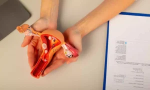 Read more about the article Opportunistic Salpingectomy May Reduce Risk of Tubo-Ovarian Carcinoma, Finds JAMA Research