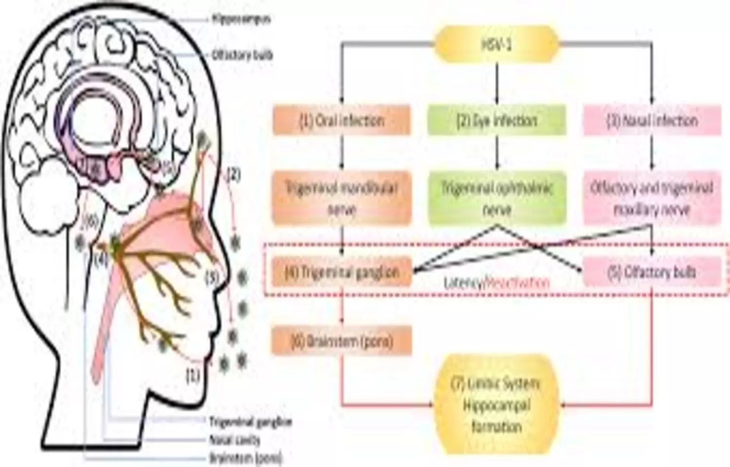 Cognitive Worsening and Absence of Benefit in HSV-Seropositive Early Alzheimer Disease: JAMA