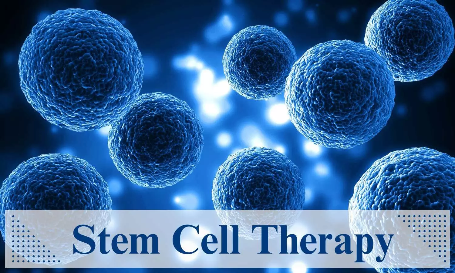 You are currently viewing In-Utero Stem Cell Therapy for Myelomeningocele Shows Early Safety and Feasibility: The Lancet
