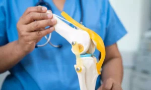 Read more about the article Diacerein Ineffective for Knee Pain in Osteoarthritis with Effusion-Synovitis: JAMA