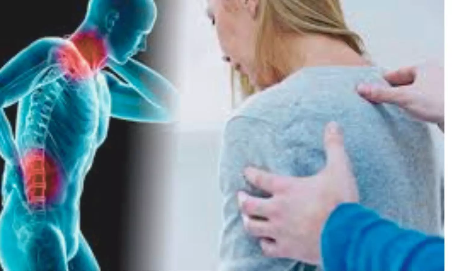 You are currently viewing Depression Relief, Not Pain Control, Drives Improvement in Fibromyalgia Patients With Emotional Distress: Study Finds