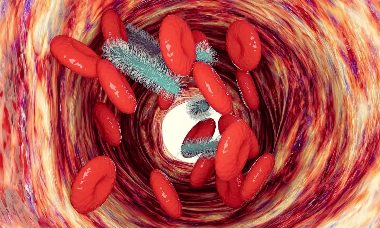 You are currently viewing Precision Immunotherapy Improves Organ Dysfunction in Sepsis: Study