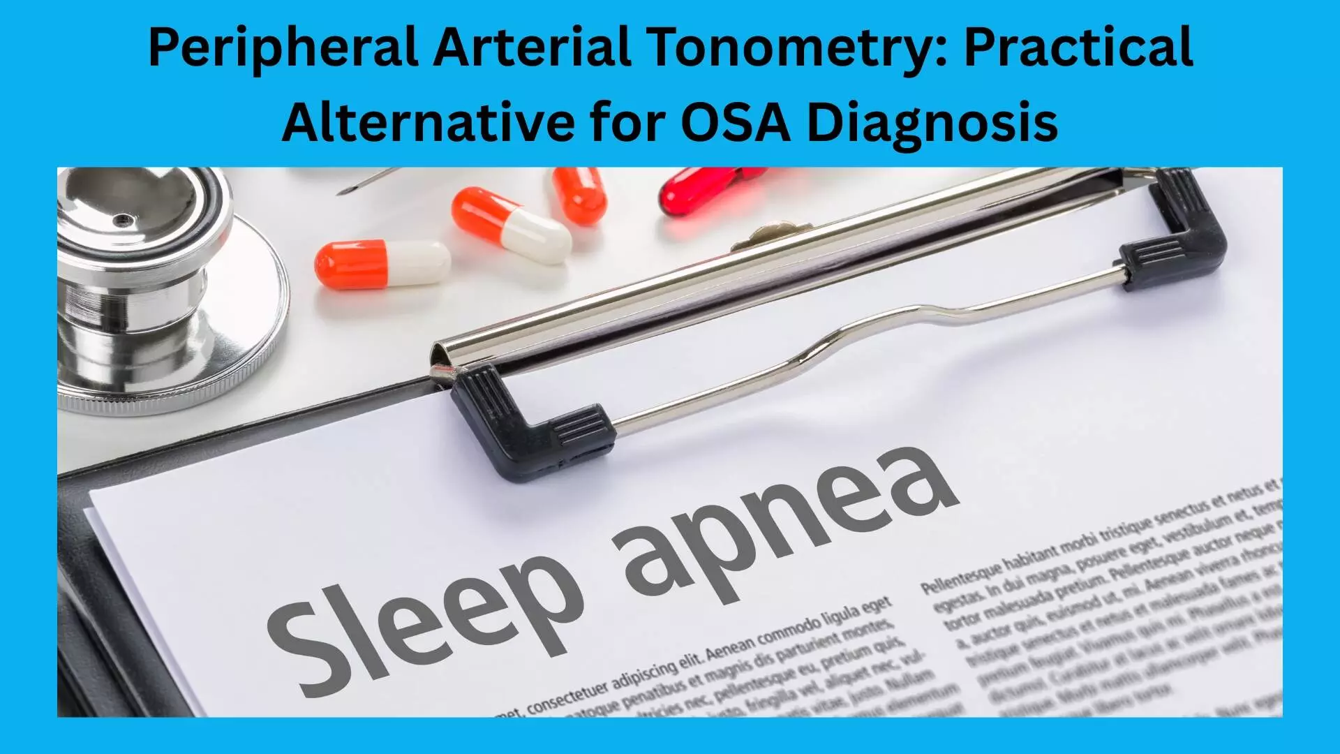 You are currently viewing Beyond Polysomnography: Study Reveals Peripheral Arterial Tonometry-Based Testing Proves Effective in OSA Diagnosis