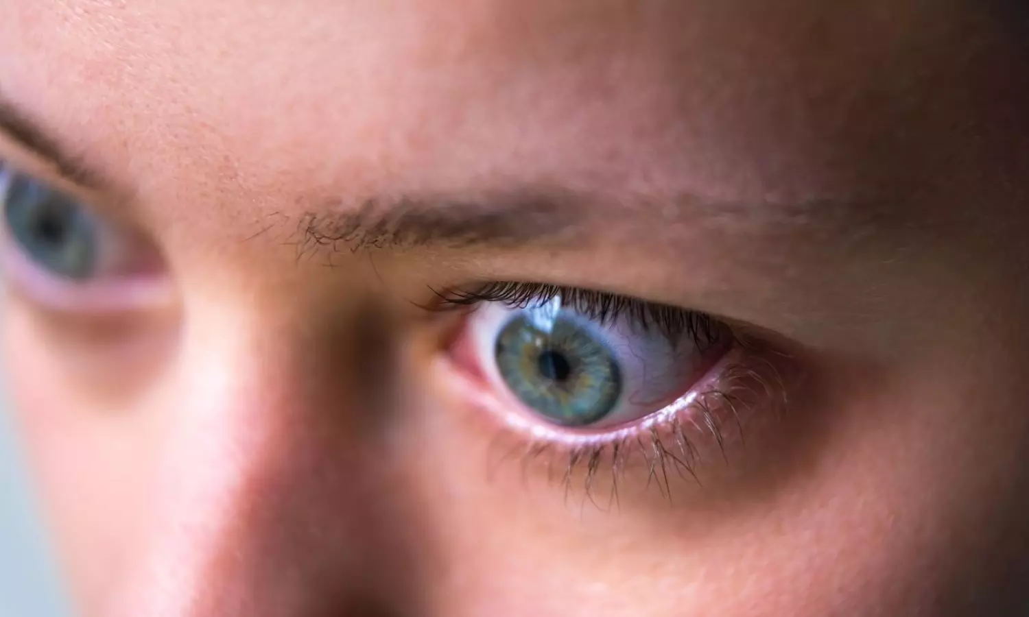 Read more about the article Elegrobart Shows Promising Results in Thyroid Eye Disease in Phase 3 trial