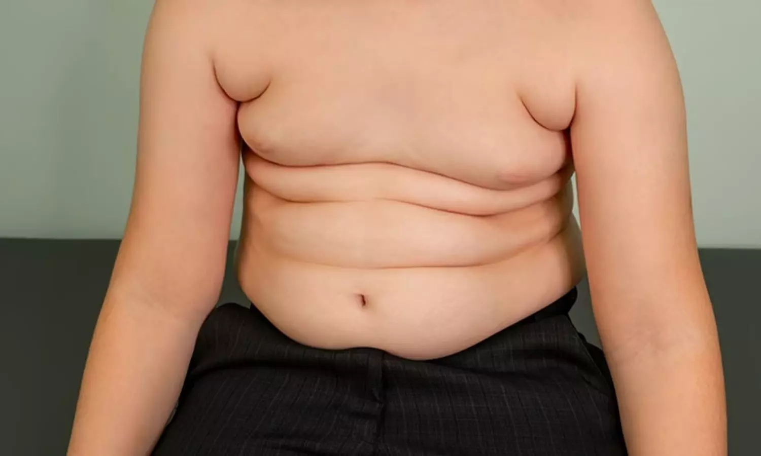 Read more about the article BMI Reduction Improves Cardiometabolic Risk in both metabolically healthy and unhealthy Obese Children: JAMA