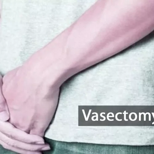 Vasectomy More Cost-Effective Than Salpingectomy for Permanent Contraception, Reveals Research
