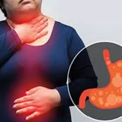 Asymptomatic Barrett’s esophagus patients exhibit pathological reflux despite PPI treatment: Study