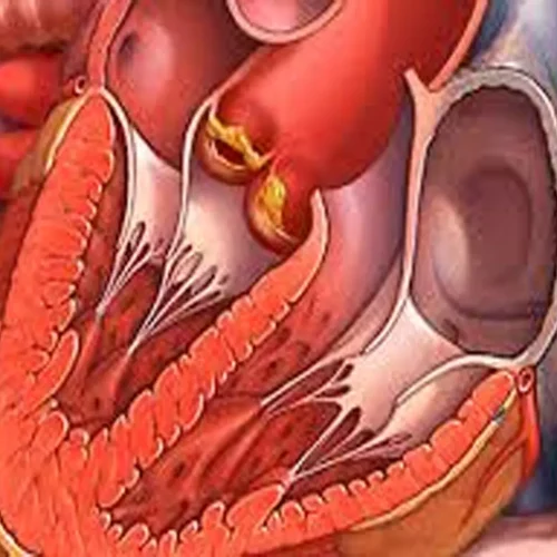 Female Patients with Culture-Negative Endocarditis Face Worse Prognosis,  suggests study
