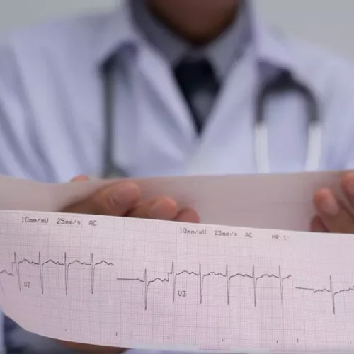 Deep learning model helps in identifying the risk of complete heart block, finds JAMA