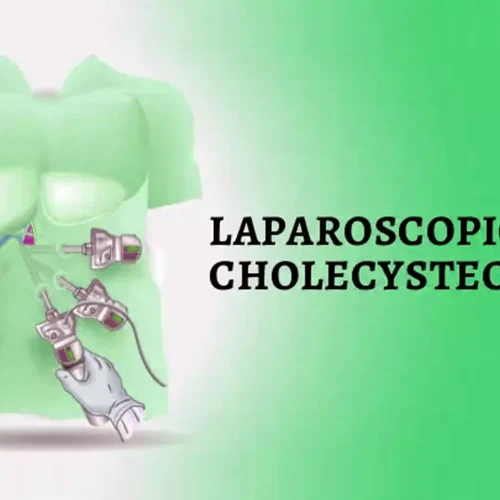 Laparoscopic Cholecystectomy Safe and Feasible in Pregnancy: Study