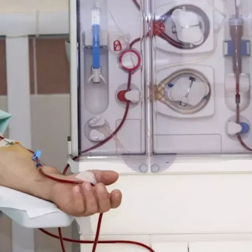 Subcutaneous Epoetin as Effective as IV, More Dose-Efficient in Hemodialysis Patients: Study