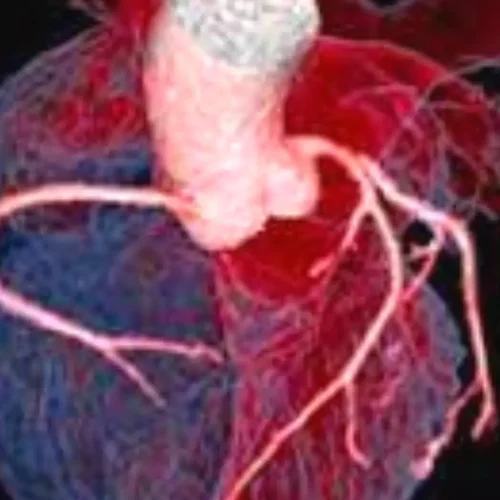 Microvascular Resistance Index: November 2025, AJC Study Reveals New Prognostic Tool for Heart Attack Patients