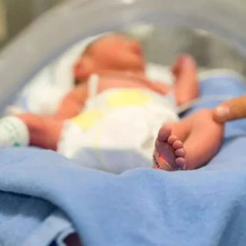 Harnessing Artificial Intelligence to Predict Reintubation in Pediatric Cardiac Surgery: Insights from study