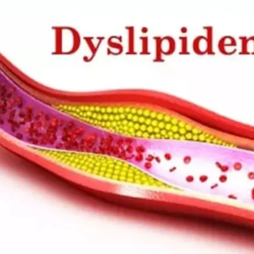 ESC/EAS 2025 Update Brings New Recommendations on Cholesterol Management and Risk Assessment