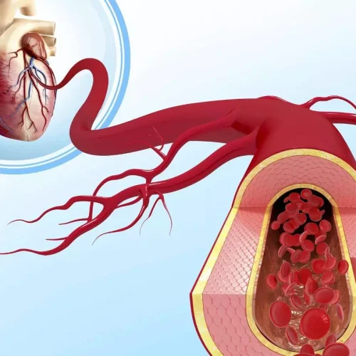 Routine heart CT scanning not warranted after stenting for left main CAD: ESC Study