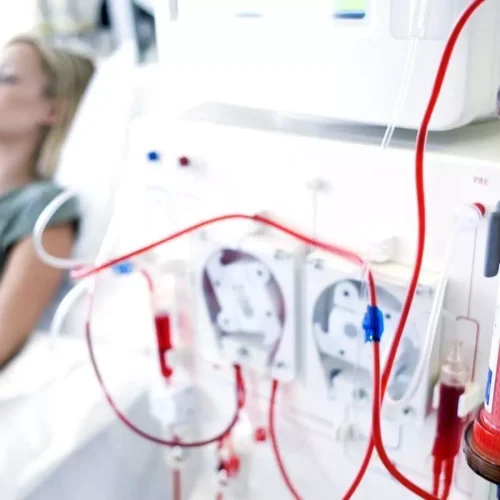 Vascular access status  strongly linked with demoralization syndrome in Elderly maintenance hemodialysis Patients: Study