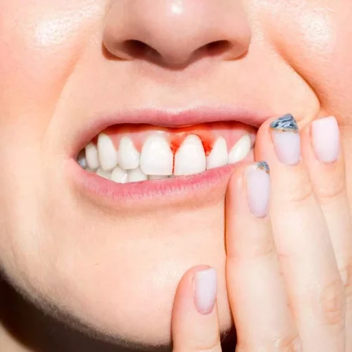 Gum disease associated with changes in the brain,  reveals research