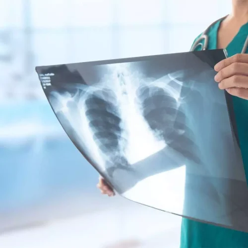Nurse-Performed Lung Ultrasound Shows High Specificity for Pulmonary Congestion: Study