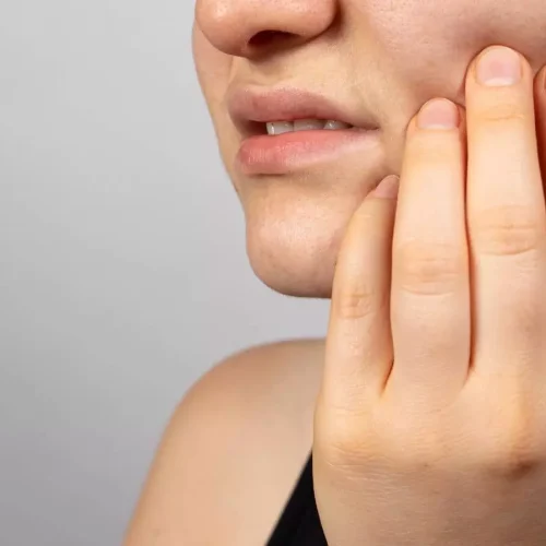 Titanium Brushes Non-Inferior to Implantoplasty in surgical treatment of peri implantitis: Study