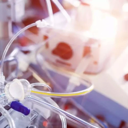 Levosimendan Fails to Improve ECMO Weaning in Severe Cardiogenic Shock, LEVOECMO Trial Reports