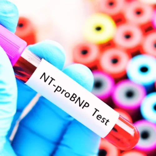 High NT-proBNP Levels Linked to Longer Hospital Stay and Higher Mortality in HF Patients: Study