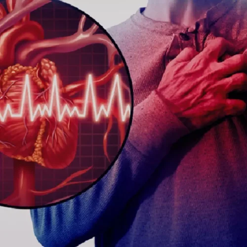 Ivabradine did not reduce occurrence of myocardial injury after noncardiac surgery: ESC Study