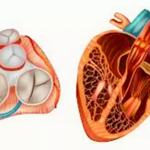 Echo-Based Rheumatic Heart Disease Prevalence in School-Going Children —Report from Meghalaya