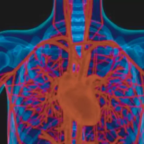 Study Links Metabolic Syndrome to Adverse Coronary Plaque Profiles in T2DM