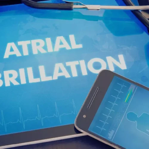 Pulsed field ablation not superior to radiofrequency ablation in paroxysmal atrial fibrillation: ESC Study
