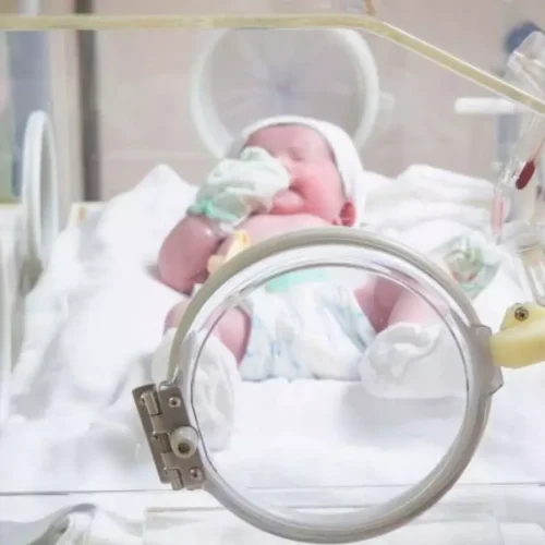 Fluid Restriction Fails to Improve PDA Outcomes, Hampers Growth in Preterm Infants: Study Shows