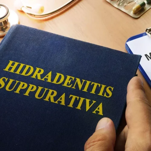 Hidradenitis Suppurativa Linked to Higher Risk of Serious Eye Diseases: Study