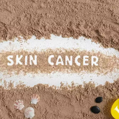 Atopic dermatitis patients undergo increased risk of nonmelanoma skin cancer: Study