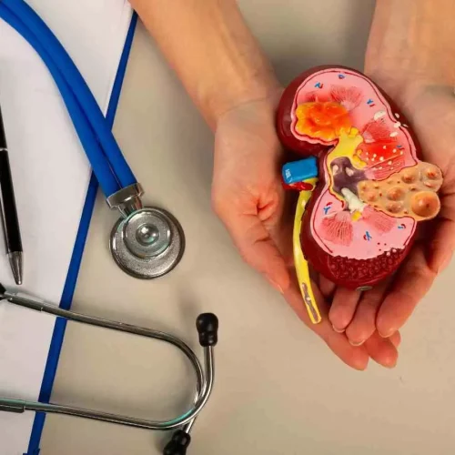 Greater Kidney Complications in Patients Diagnosed with Type 2 Diabetes Before 40: Study Finds