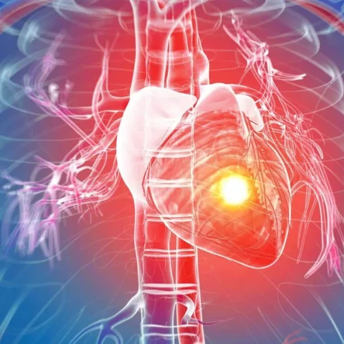 Silent Heart Attacks Pose Long-Term Health Risks for Men Than Women: Study