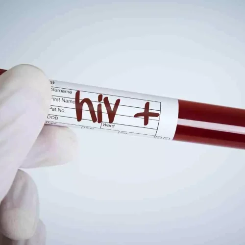 Mizoram Health Minister calls for urgent action as State leads in HIV cases