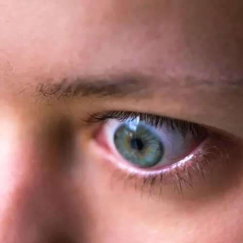 Elegrobart Shows Promising Results in Thyroid Eye Disease in Phase 3 trial