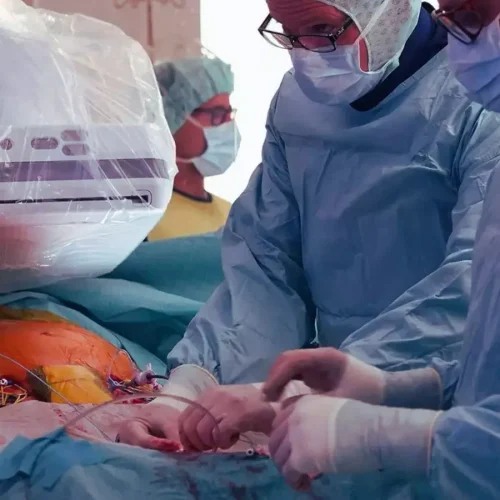 Physiology-Guided Complete Revascularization Shows Sustained 3-Year Benefit in Elderly MI Patients: JAMA