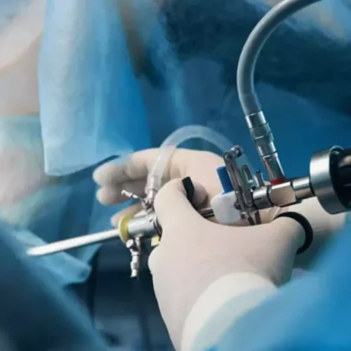 Hysteroscopic diagnostic criteria highly accurate and sensitive for detecting chronic endometritis: Study