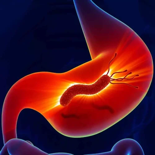 Routine Helicobacter pylori screening does not significantly reduce upper GI bleeding in patients after MI: ESC Study