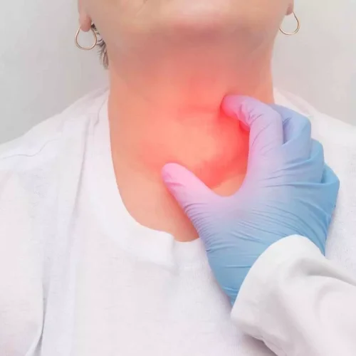 Early recognition and surgical management key in necrotizing fasciitis of head and neck: Study