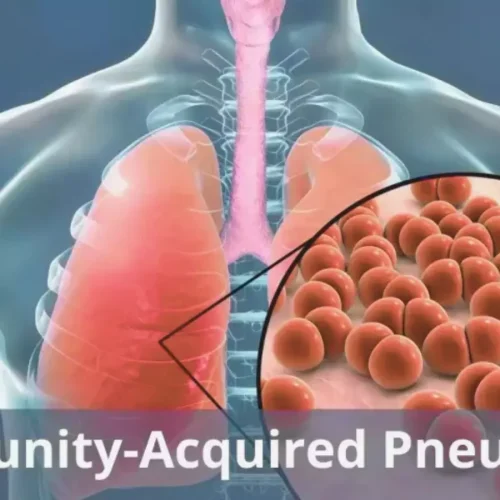 Traditional Chinese Medicine Injections Show Potential Benefit in Older Adults With Community-Acquired Pneumonia