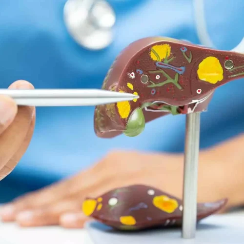 Blood Test–Based Scoring Tool Detects Hidden Alcohol-Related Liver Disease: Study