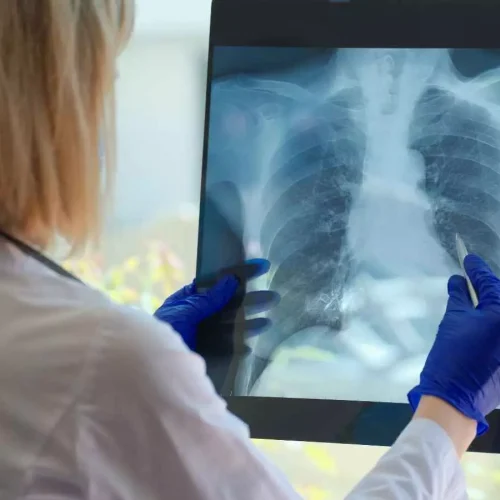 Inhaled Treprostinil Slows Disease Progression in idiopathic pulmonary fibrosis: NEJM