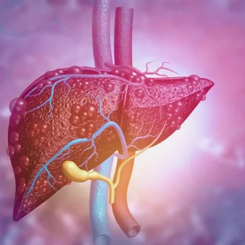 Study Finds GLP-1 RAs May Lower Liver and Heart Complications in MASLD Patients with Diabetes
