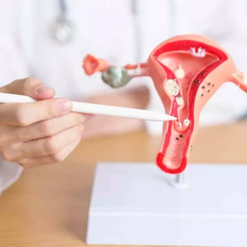 TENS Improves Quality of Life and Reduces Analgesic Use in Endometriosis: Study